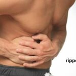 Rippenprellung